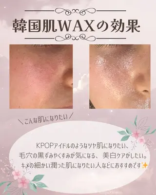 abbellina×UNO出雲塩冶店《ウノ》所属・フェイシャルエステ 🫧琉衣のエステ・リラクイメージ