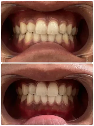 メンズ bright梅田所属・甲斐 優衣のその他イメージ