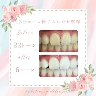 セルフホワイトニング Dolce水戸店のその他イメージ