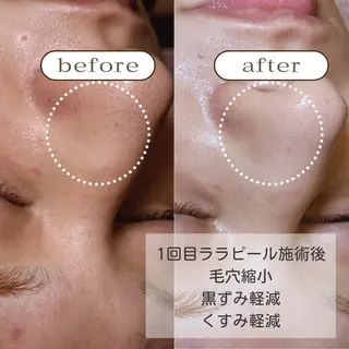 美肌・痩身・脱毛当日 予約◎ZENITHのエステ・リラクイメージ