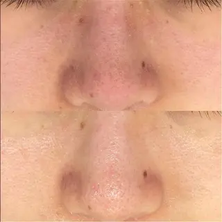 CE salon Euluna所属・CE salon Eulunaのエステ・リラクイメージ