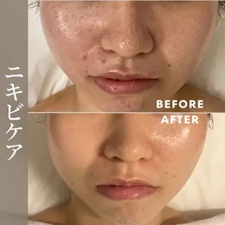 肌育成サロン ♡ RISAのエステ・リラクイメージ