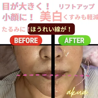 akua... 【肌質管理専門】のその他イメージ