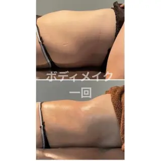 筋膜リリースエステ ESENCIAのエステ・リラクイメージ