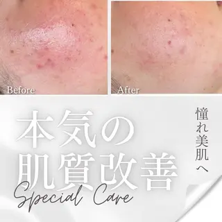 💚THE BALM 金子💚✨のエステ・リラクイメージ