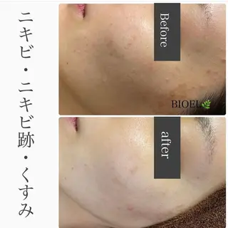 ハーブピーリング専門 BIOPLUS＋川崎のエステ・リラクイメージ