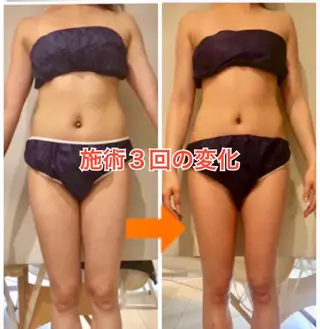 ショート カラー パーマ ヘアアレンジ メンズ キッズ ネイル マツエク・マツパ ‍痩身＆ボディ 結果出し🌟丹野のエステ・リラクイメージ