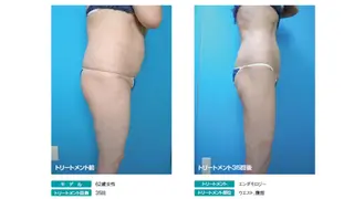 オレンジバナナ 県央店のエステ・リラクイメージ