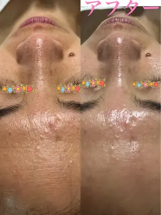 うえつま ふみえのエステ・リラクイメージ