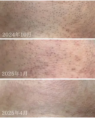 メンズ Lys Blanc OTOKAのエステ・リラクイメージ