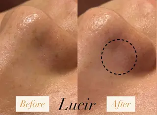 ルシール所属・脱毛&小顔コルギ 専門店 Lucirのエステ・リラクイメージ