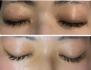 フェイシャル/毛穴 /シミ/たるみ東灘区のエステ・リラクイメージ