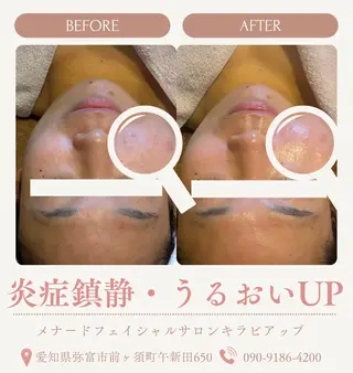 メナードフェイシャルサロンキラビアップ所属・肌改善・美肌サポート 🤍tokoのエステ・リラクイメージ