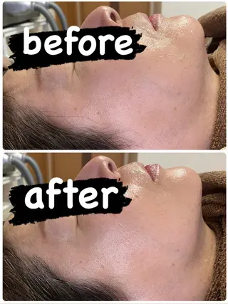 【痩身・脱毛サロン】 REBISKIN🌱のエステ・リラクイメージ