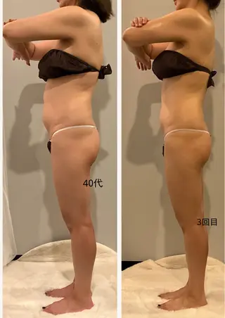 ✨痩身 ✨ハイパーナイフEXのエステ・リラクイメージ