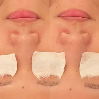 毛穴ケア/毛穴診断/ 毛穴洗浄〔心斎橋〕のエステ・リラクイメージ