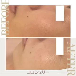 エステサロン シェリーのエステ・リラクイメージ