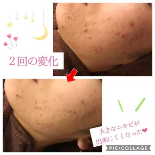 セミロング カラー パーマ ヘアアレンジ メンズ キッズ ネイル マツエク・マツパ 四つ星サロン🎖 腸＆ニキビケアに特化のエステ・リラクイメージ