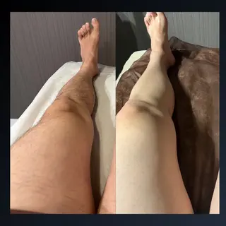 メンズ Grast所属・脱毛＆眉毛サロン メンズ専用Grastのエステ・リラクイメージ