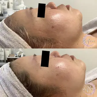 まつ毛パーマ・美肌 ナチュラル　ボーテのマツエク・マツパデザイン