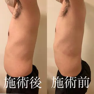 WOM SALON所属・MIKU【美容整形ダ ウンタイムケア銀座】のエステ・リラクイメージ