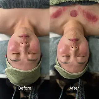 かっさ吸玉サロン Fluentのエステ・リラクイメージ