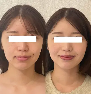 小顔/たるみ/黒ずみ除去専門サロン/SONA 大和西大寺店所属・【小顔専門看護師 サロンSONA】のエステ・リラクイメージ