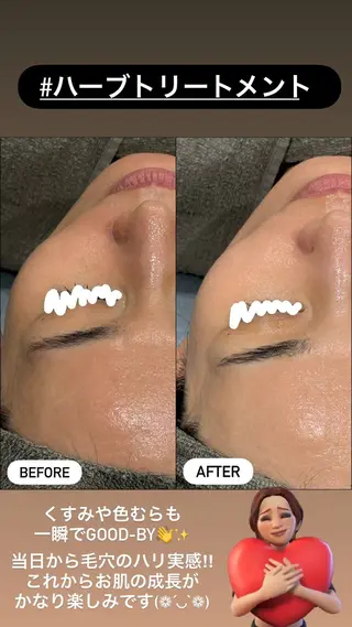 LiZA エステティックサロンのエステ・リラクイメージ