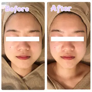 MiMiy 銀座店のエステ・リラクイメージ