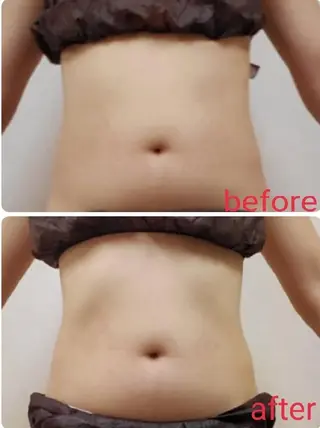 【 Laforme】 ラ・フォルムのエステ・リラクイメージ