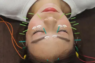 同心整骨院 美容鍼・整体・小顔のエステ・リラクイメージ