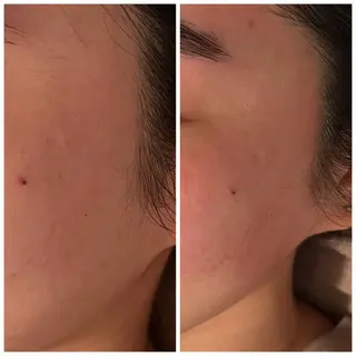 Ｂ&H所属・頭痛•肩こり専門/ 眉サロンB&H心斎橋のエステ・リラクイメージ