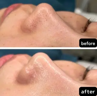 からだ びよりのエステ・リラクイメージ