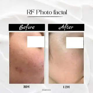 都度払いの脱毛サロンbluerois所属・都度払い専門サロン blueroisのエステ・リラクイメージ