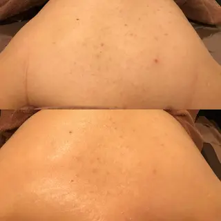 サロンドゥ ルシエルのエステ・リラクイメージ