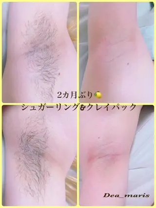 private salon  Dea_maris シュガーリング＆パーソナルボディケア所属・シミ改善・韓国肌管理 ボディメイク痩身のその他イメージ