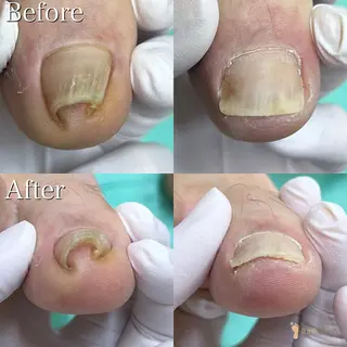 ネイル 大宮巻き爪補正店所属・大宮 巻き爪補正店のエステ・リラクイメージ