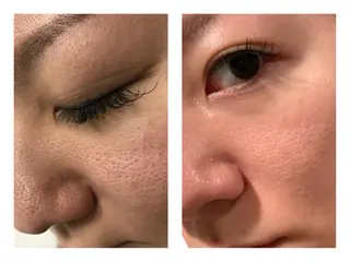 美u•p 鶴ヶ峰店のマツエク・マツパデザイン