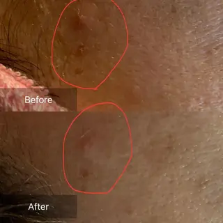 Mandarin Orange所属・毛穴から始める肌メン テマンダリンオレンジのエステ・リラクイメージ