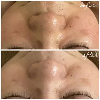 メンズ メナード岐阜茜部 杉浦のエステ・リラクイメージ