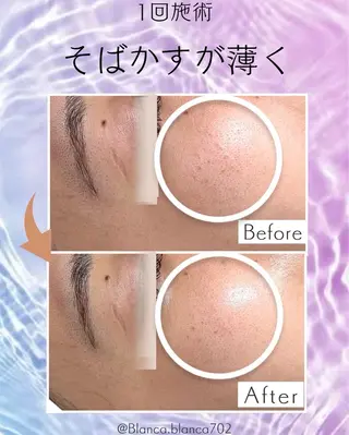 プライベートエステサロンBlanca所属・Blanca ナミキのエステ・リラクイメージ