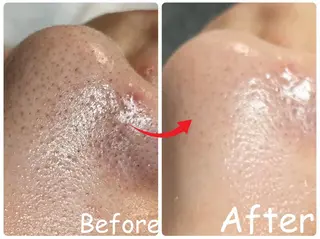 ele"ハーブ ピーリング 専門店のエステ・リラクイメージ