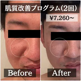 【肌質改善・リフトアップ専門店】セラピックエステ美極所属・羽賀 茉衣子のエステ・リラクイメージ