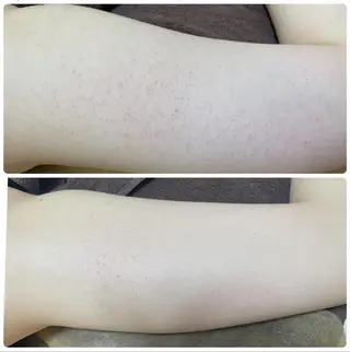 メンズ 【肌質改善サロン】 リーフィアのエステ・リラクイメージ