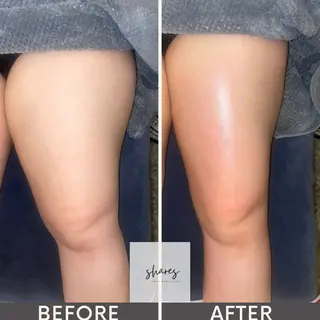 SHARES MADOKAのエステ・リラクイメージ