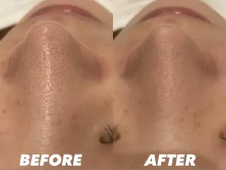 ミディアム カラー パーマ ヘアアレンジ メンズ キッズ ネイル マツエク・マツパ NANI OAFU所属・NANIOAFU [なんば店］のその他イメージ