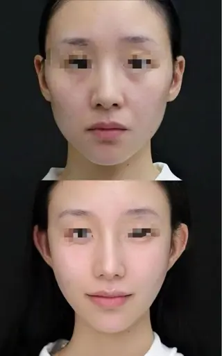 カラー aliaハイフ&水光ジェットサロン所属・aliaハーブ水光店 エステティシャン募集のエステ・リラクイメージ