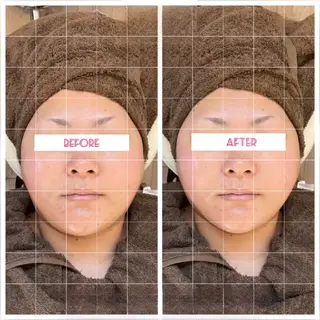 ルイスアディクト 名駅店のエステ・リラクイメージ