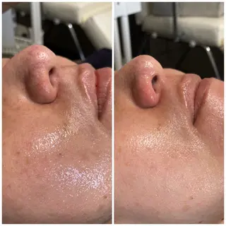 夜限定SARON YISMのエステ・リラクイメージ