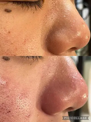 お肌のかかりつけサロンP.A.L.M.所属・【P.A.L.M.】 むき卵×毛穴レス肌のエステ・リラクイメージ